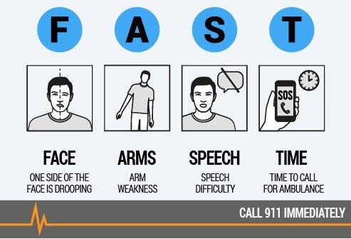 Stroke signs- FAST